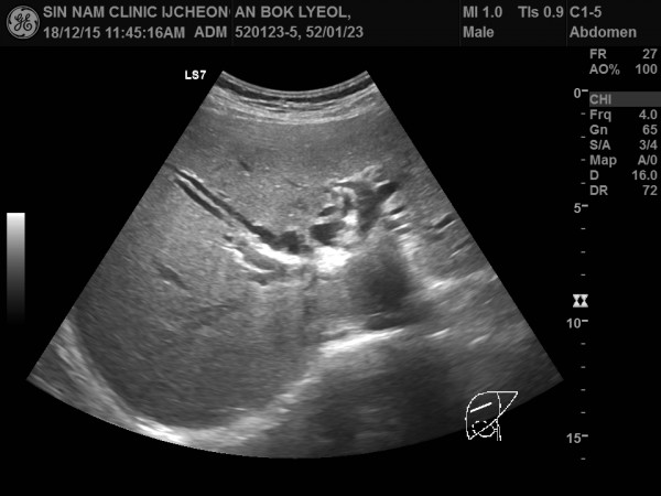 d6ad96bb41e8ffab2d3a97a6abd0238b_1755920