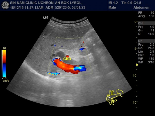 d6ad96bb41e8ffab2d3a97a6abd0238b_1755920