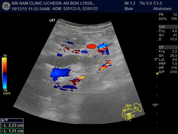 d6ad96bb41e8ffab2d3a97a6abd0238b_1755920