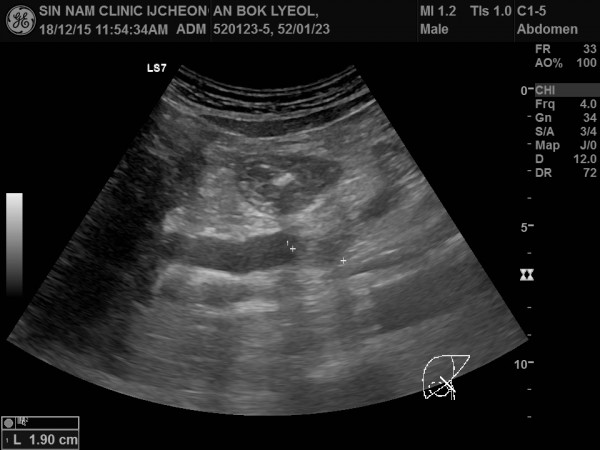 df11cede29e8e7ff81e69710e8313865_1756275