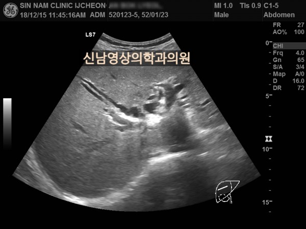 a91aa93529db81accb78722c2d5bfa6b_1757902