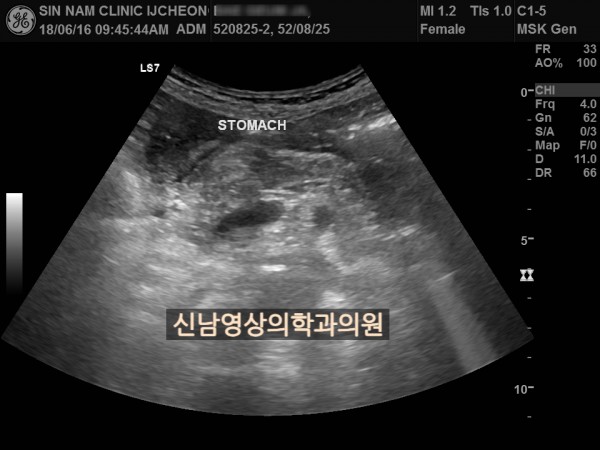 c521c0b12f3852411610eac7ec2d1b79_1757374